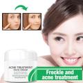 Anti Stains Acne Treatment Cream Scar Blackhead Face Cream Shrink Pores Whitening Skin Care Face Cream Korean Cosmetics. 