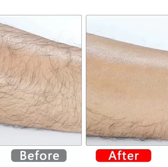 New%20Epilator%20Painless%20Hair%20Removal%20Exfoliation%20-%201pc%20-%20Image%204