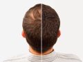 Hair Fiber Pack of 3 Fiber 27.5 gm + Applicator + Comb |  Black. 