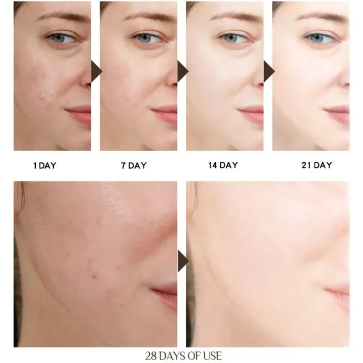 UPTOWN%20LA%20Hydro%20Boost%20Hyaluronic%20Acid%20Hydrating%20%20Cream%20Daily%20Face%20Moisturizer%20for%20%20Boosting%20Skin%20glow%20&%20Elasticity%20-%20Image%204