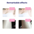 MomDaughts' HR IPL Laser Hair Removal Machine SM-888 - Permanent Female Hairs Removing Pulsed Light Electric Depilatory Device For Facial Body Bikini. 