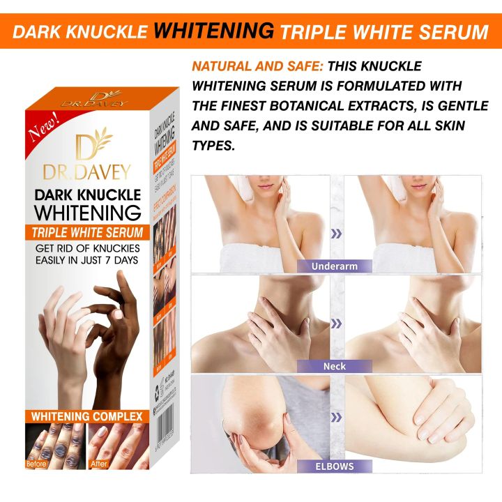 DR.DAVEY%20Dark%20Knuckle%20Whitening%20Triple%20White%20Serum%20-%20Fast%20Results%20in%207%20Days%20%7C%20Say%20Goodbye%20to%20Knuckles%20Easily%20-%20Brightening,%20Moisturizing,%20Skin%20Renewal%20Formula%20-%20Image%204