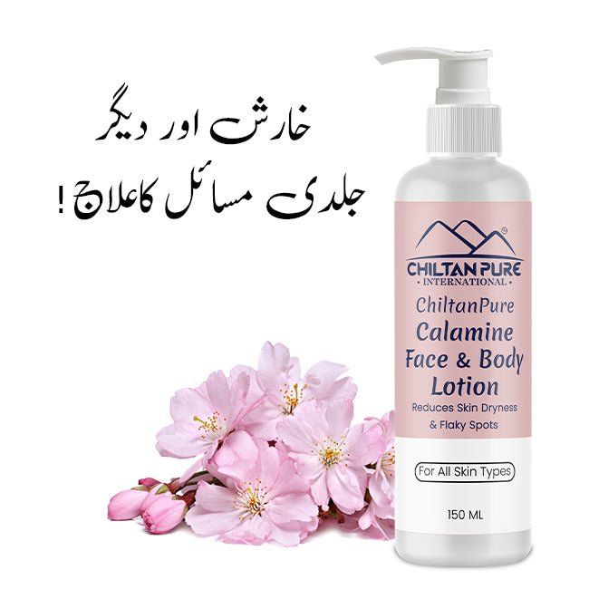 Calamine Lotion – Solution to every allergy, contains anti-allergic properties, Reduces skin dryness – 100% organic