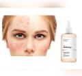 The Ordinary Glycolic Acid 7% Exfoliating Toner. 