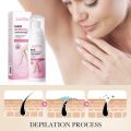 Sadoer Private Parts Hair Removal Spray Flawless Smooth Skin Permanent For Men & Women SD50066. 