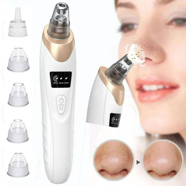5-in-1 Blackhead & Acne Remover Machine: Pore Vacuum, Pimple Popper ...