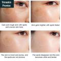 Pack of 4  Skincare Bundle - - Whitening Cream - Scar Removal Cream - Kojic Acid Cream - Skin Whitening Serum - Target hyperpigmentation and dark spots. 