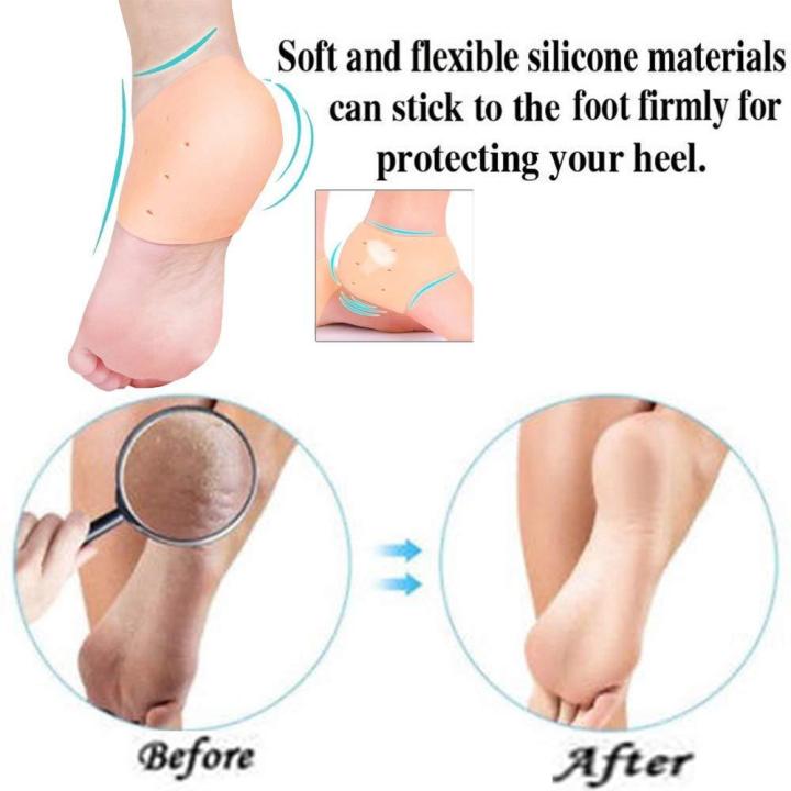 Silicone%20Anti-Crack%20Pain%20Reliever%20-%20Image%207