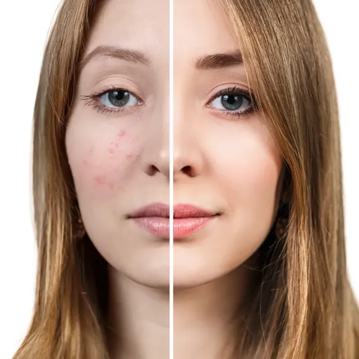 Face%20Fresh%20Cleanser%20Face%20Wash%20(60ml)%20-%20Image%207