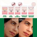 Dark Spot Correcting Glow Serum Fade Pigment Freckle Melasma Melanin Improves Dull Skin Facial Whitening Brightening Essence Moonlight. 