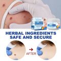 Eelhoe Skin Tag Remover Warts & Mole Remover Cream Remove Skin Tag Wart Callus Natural Ingredients Scar-Free Wart Ointment 30G. 