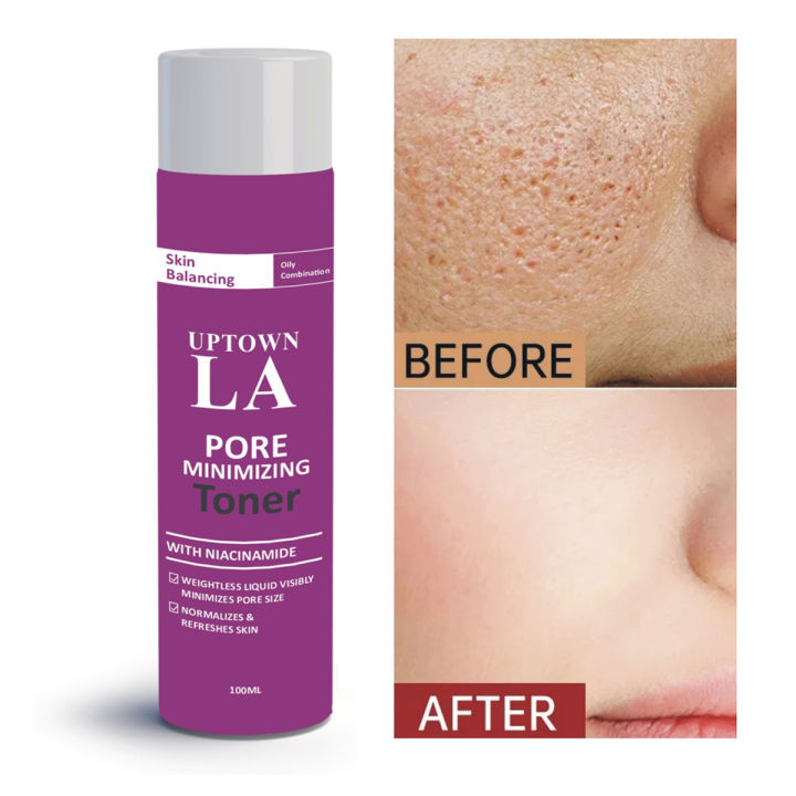 Uptown%20LA%20Pore%20minimizing%20Perfection%20Toner%20-%20100ml,%20Minimize%20Pores%20for%20Radiant%20Skin%20-%20Image%202