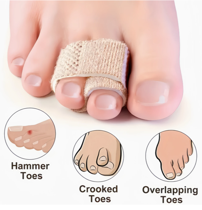 Toe Separators & Broken Toe Wraps – Soft Fabric Toe Splint, Cushioned Toe Bandages & Finger Protectors for Pain Relief, Alignment & Injury Recovery"