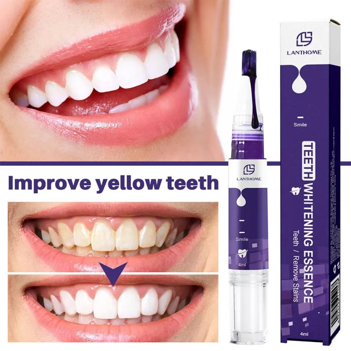 V34%20Teeth%20Whitening%20Pen%20Purple%20Whitening%20Toothpaste%20Dental%20Whitening%20Tartar%20Removal%20Tooth%20Cleaning%20Effective%20Teeth%20Whitener%204ml%20-%20Image%205