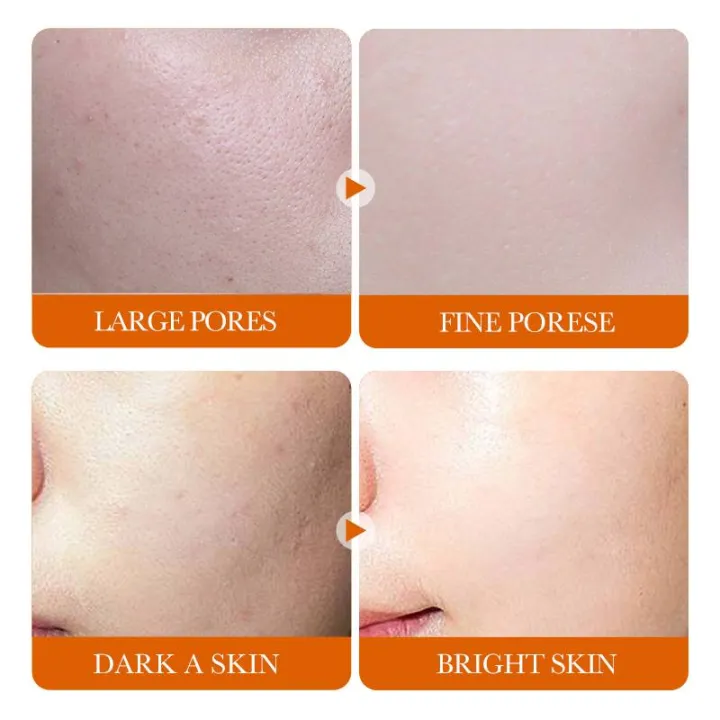 Bioaqua%20Vitamin%20C%20White%20Brighten%20Face%20Serum%2030ml%20BQY38432%20-%20Image%203
