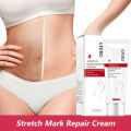 EFERO Repair Cream Removal Scar Stretch Marks Postpartum Maternity Skin Solution. 