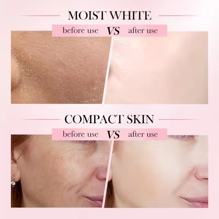 SADOER%204%20In%201%20Facial%20Cream%20Repair%20Nourishing%20Whitening%20Moisturizing%20Skin%20Care%20Anti%20Wrinkle%20Anti%20Aging%20Hyaluronic%20Acid,%20Nicotinamide,%20Vitamin%20C,%20E%20Face%20Cream%20SD02495%20-%20Image%205