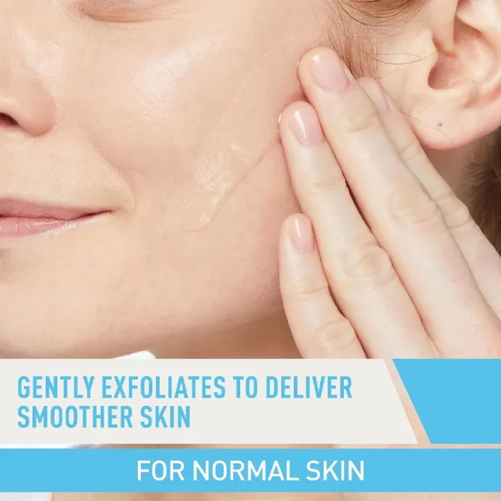 Acne%20Foaming%20Cream%20Cleanser%204%25%20%20Acne%20Treatment%20150ml%20-%20Image%205