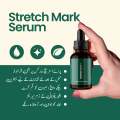 Markaway Stretch Mark Serum | Advanced Skin Repair Formula | Reduces Stretch Marks, Scars & Uneven Skin Tone 30ml. 