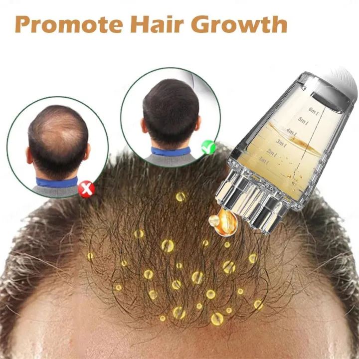 6ml%20Scalp%20Applicator%20Scalp%20Nutrient%20Brush%20Liquid%20Comb%20Portable%20Massage%20Hair%20Comb%20Essential%20Oil%20Liquid%20Guiding%20Comb%20Hair%20Scalp%20Treatment%20Massage%20Brush%20Daily%20Hair%20Tools%20-%20Image%202