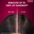 Permanent Anti Dandruff Shampoo. 