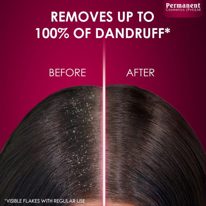 Permanent%20Anti%20Dandruff%20Shampoo%20-%20Image%204