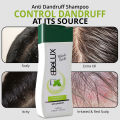 WBM Belux Anti Dandruff Shampoo 400 ml | Shampoo for Scalp. 