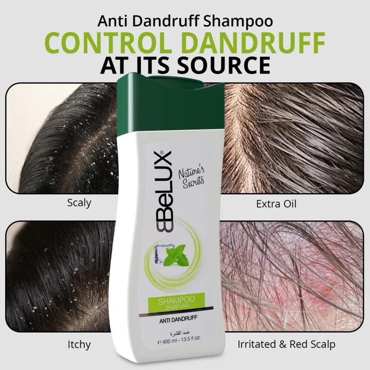 WBM%20Belux%20Anti%20Dandruff%20Shampoo%20400%20ml%20%7C%20Shampoo%20for%20Scalp%20-%20Image%204
