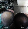 hair growth oil for men and women - Hair growth and Hair care oil - Made in Vietnam hair growth oil. 