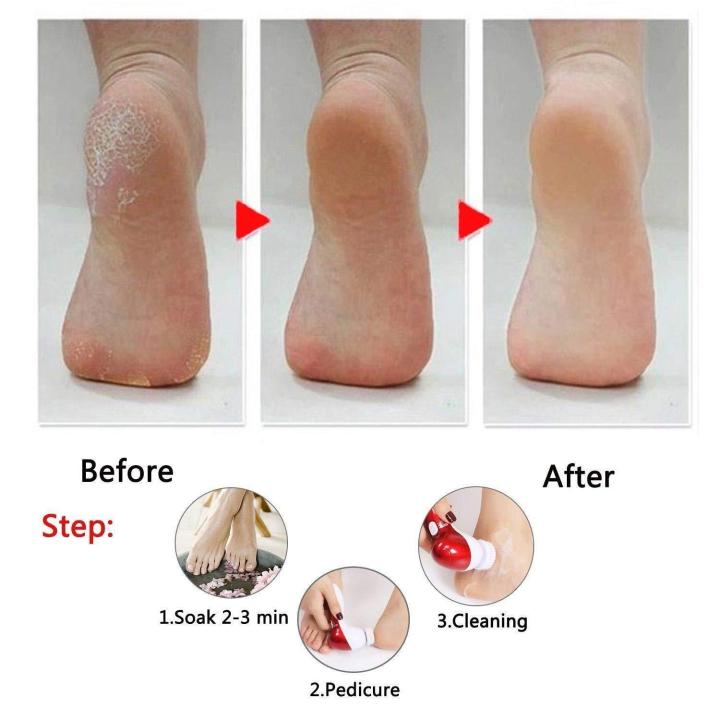 11%20in%201%20Face%20Facial%20Exfoliator%20Electric%20Massage%20Machine%20Care%20&%20Cleansing%20Cleanser%20Massager%20Kit%20For%20Smoothing%20Body%20Beauty%20Care%20Skin%20Face%20Cleaner%20Massage%20Machine%20facial%20massager%20machine%20for%20face%20-%20Image%206