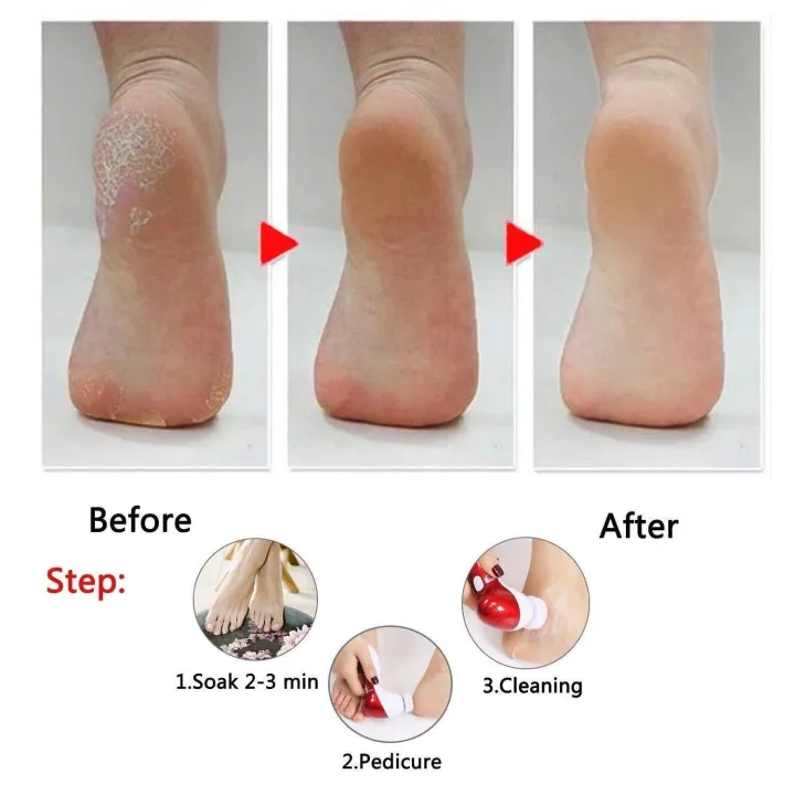 11%20in%201%20Face%20Facial%20Exfoliator%20Electric%20Massage%20Machine%20Care%20&%20Cleansing%20Cleanser%20Massager%20Kit%20For%20Smoothing%20Body%20Beauty%20Care%20Skin%20Face%20Cleaner%20Massage%20Machine%20facial%20massager%20machine%20for%20face%20-%20Image%206