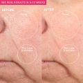 PMD Personal Microderm Pro - At-Home Microdermabrasion Machine with Kit for Face & Body. 