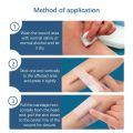 Wound Skin Closure Strips Postpartum Wound Repair Cosmetic Surgery Steri Strip Adhesive Medical Suture Free Surgical Tape. 