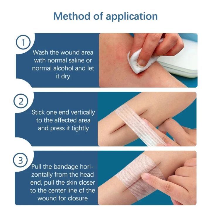 Wound%20Skin%20Closure%20Strips%20Postpartum%20Wound%20Repair%20Cosmetic%20Surgery%20Steri%20Strip%20Adhesive%20Medical%20Suture%20Free%20Surgical%20Tape%20-%20Image%204