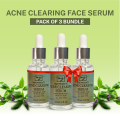 PACK OF 3-MZ SKIN PRODUCTS ACNE CLEARING FACE SERUM - 30ML |SERUM | AVAILABLE AT MZ SKIN PRODUCTS. 
