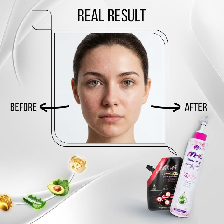 Glow%20Synergy%20Pack%20-%20Quick%20Skin%20Healing%20Malika%20Brightening%20Face%20&%20Body%20Lotion%20-%20Overnight%20Results%20Malika%20-%20Body%20Lotion%20-%20Emulsion%20-%20Whitening%20Cream%20-%20Quick%20Skin%20Healing%20Cream%20-%20Family%20Budget%20-%20Protects%20Against%20Dullness%20-%20Best%20Duo%20-%20Image%202