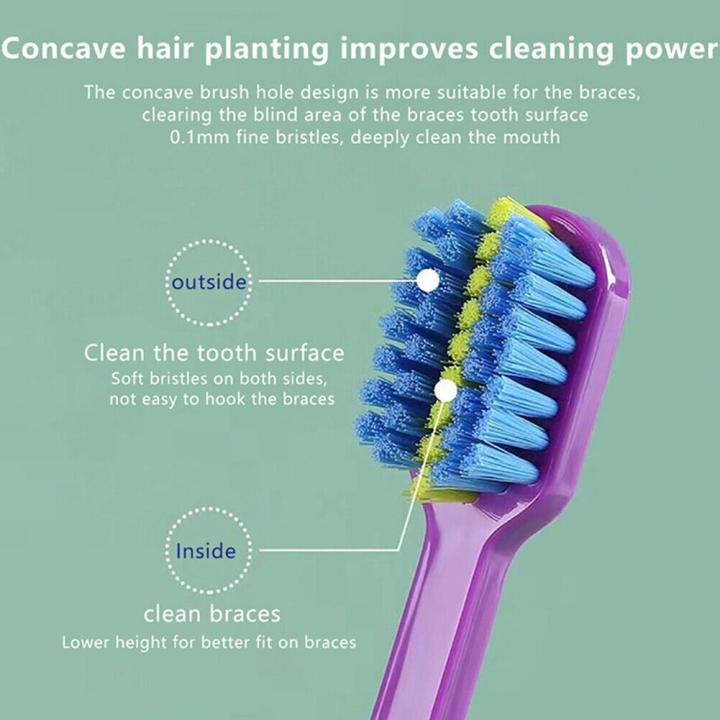 Professional%20Orthodontic%20Toothbrush%20Soft%20Bristle%20Interdental%20Brush%20Orthodontic%20Braces%20Brush%20For%20Adult%20Oral%20Hygiene%20Care%20Tool%201pc%20-%20Image%205