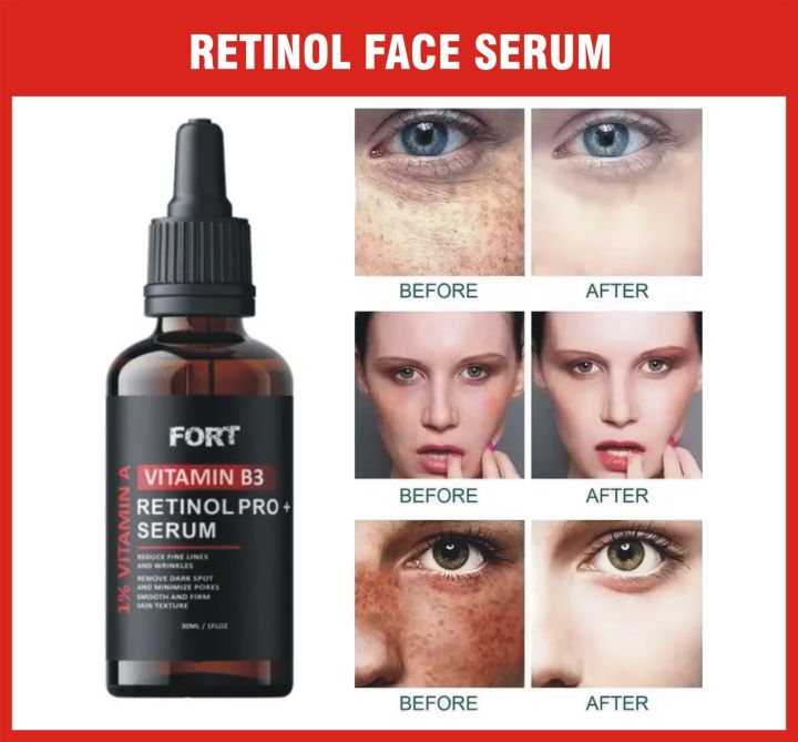 Fort 1 % Retinol Face Serum  Anti Aging Face Serum for Lines, Wrinkles & | Glass Skin Care Products