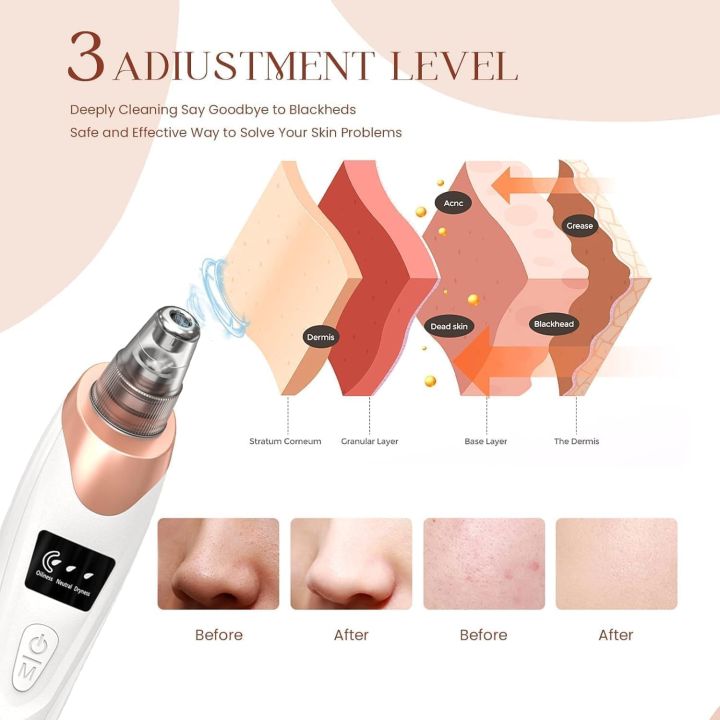 5%20in%201%20Electric%20Blackhead%20Acne%20Oil%20Remover%20Vacuum%20Suction%20with%206%20Fruit%20Plant%20Extract%20Moisturizing%20Brighten%20Facial%20Sheet%20Mask%20-%20Image%207