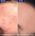 Jenpharm - Clarevo Salicylic Acid Facewash. 