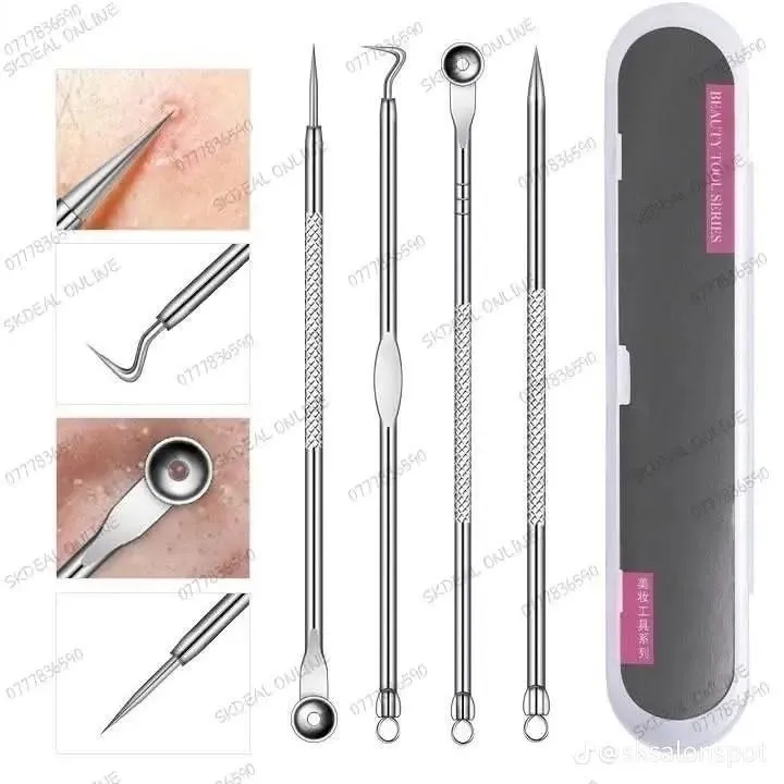4%20Pieces%20Acne%20Extractor%20Tool%20Kit%20%E2%80%93%20Safe%20Blackhead,%20Whitehead%20&%20Pimple%20Removal%20Set%20-%20Image%203