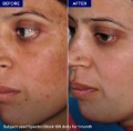 SPECTRA BLOCK MAX 100 SPF 100 | No White Residue. 