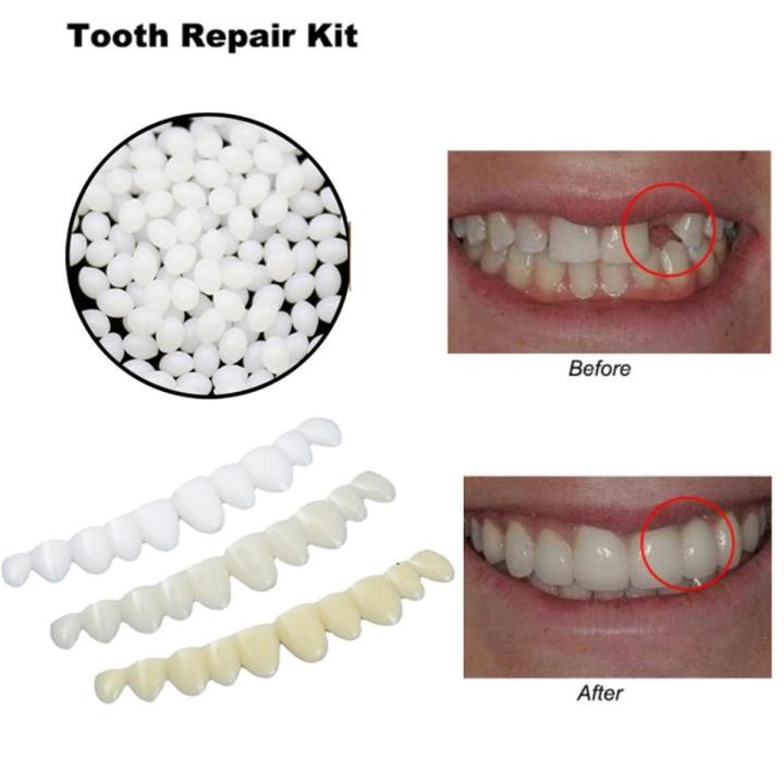 3 Shades /set Temporary Dental Oral False Teeth Dentures Perfect Smile Veneers Creek
