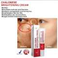 Chalonese Brightening Cream 20g for Dark Spots, Pigmentation & Acne Marks | Advanced Skin Brightening Formula for Uneven Tone, Dull Skin & Melasma | Daily Face Cream for Visible Glow. 