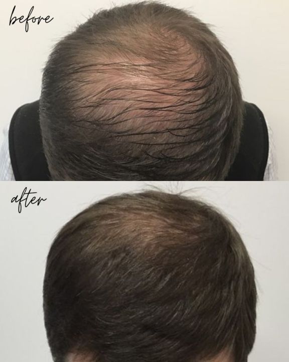 ZF%20Magic%20Oil%2060%20ML%20&%20100%20ML%20for%20Hair%20Care%20%7C%20Pure%20Natural%20Oil%20%7C%20Hair%20Growth%20Oil%20for%20Stronger%20&%20Healthier%20%7C%20Hair%20Frizz%20Control,%20Extra%20Strength%20Hair%20Oil,%20Stop%20Hair%20Fall%20%7C%20Nourish%20Shiny%20Hair%20-%20Image%205