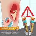 Bedsore Treatment Cream Pressure Sore Ulcer Skin Rot Necrotic repair Relief Ointment Bed Sore Wound Healing Decubitus Feet Care. 