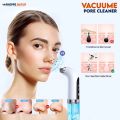 Blackhead Removal Machine - Hydra Dermabrasion Blackhead Remover - Pore Vacuum Cleaner - Bubble Facial Vacuum Cleaner - Blackhead Remover Machine - Deep Face Cleanser - Pimple Remover - Pores Cleaner - Anti-Aging Hydro Skin Care Beauty Machine. 