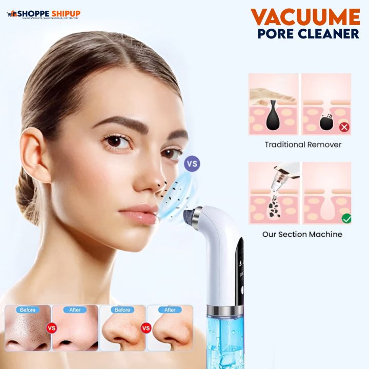 Blackhead Removal Machine - Hydra Dermabrasion Blackhead Remover - Pore Vacuum Cleaner - Bubble Facial Vacuum Cleaner - Blackhead Remover Machine - Deep Face Cleanser - Pimple Remover - Pores Cleaner - Anti-Aging Hydro Skin Care Beauty Machine