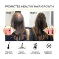 Natural Ginger Hair Growth Products For Men And Women Anti Hair Loss Oil Fast Regrowth Thicken Scalp Hair Growth Serum 30g. 