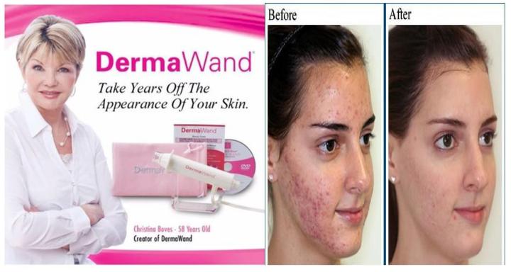 Derma%20Wand%20Anti%20Aging%20High%20Freq%20Facial%20Micro%20Pen%20Laser%20-%20Image%205
